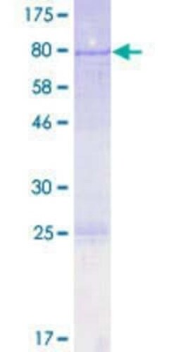 Novus Biologicals Recombinant Human ROD1 GST (N-Term) Protein 2 &mu;g | Buy Online | Novus Biologicals&trade; | Fisher Scientific