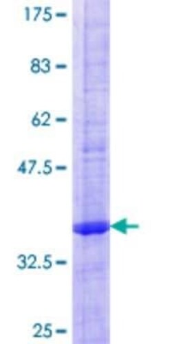 Novus Biologicals Recombinant Human MiRP1 GST (N-Term) Protein 25 &mu;g | Buy Online | Novus Biologicals&trade; | Fisher Scientific