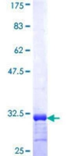 Novus Biologicals Recombinant Human MiRP1 GST (N-Term) Protein 10 &mu;g | Buy Online | Novus Biologicals&trade; | Fisher Scientific