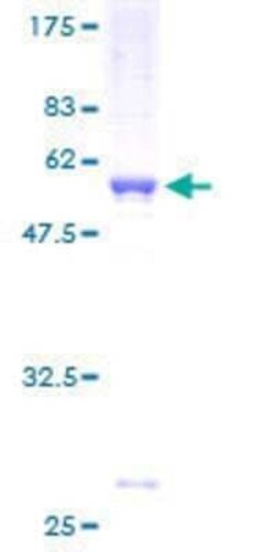 Novus Biologicals Recombinant Human MED6 GST (N-Term) Protein 2 &mu;g | Buy Online | Novus Biologicals&trade; | Fisher Scientific