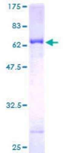 Novus Biologicals Recombinant Human PNR/NR2E3 GST (N-Term) Protein 10 &mu;g | Buy Online | Novus Biologicals&trade; | Fisher Scientific
