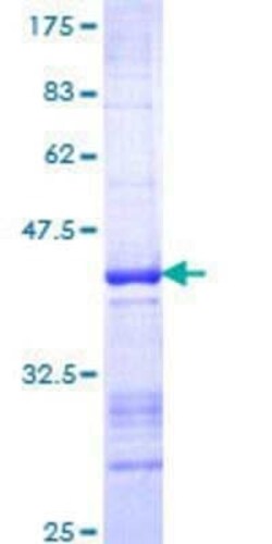 Novus Biologicals Recombinant Human Kaiso GST (N-Term) Protein 25 &mu;g | Buy Online | Novus Biologicals&trade; | Fisher Scientific