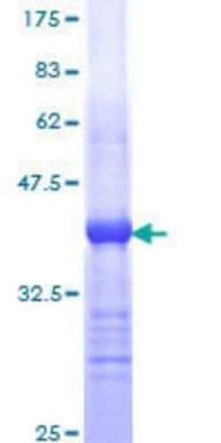 Novus Biologicals Recombinant Human HDAC6 GST (N-Term) Protein 25 &mu;g | Buy Online | Novus Biologicals&trade; | Fisher Scientific