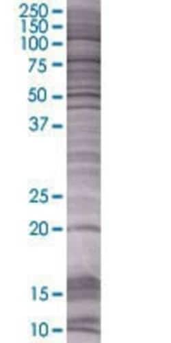 Novus Biologicals BCL2L10 293T Cell Transient Overexpression Lysate 0.1 mL | Buy Online | Novus Biologicals&trade; | Fisher Scientific