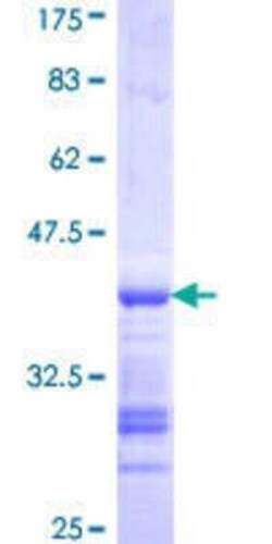 Novus Biologicals Recombinant Human TROAP GST (N-Term) Protein 25 &mu;g | Buy Online | Novus Biologicals&trade; | Fisher Scientific