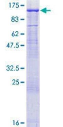 Novus Biologicals Recombinant Human MED16 GST (N-Term) Protein 10 &mu;g | Buy Online | Novus Biologicals&trade; | Fisher Scientific