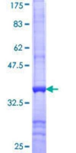 Novus Biologicals Recombinant Human TOM1L1 GST (N-Term) Protein 25 &mu;g | Buy Online | Novus Biologicals&trade; | Fisher Scientific