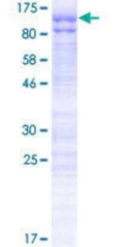 Novus Biologicals Recombinant Human HMG2L1 GST (N-Term) Protein 2 &mu;g | Buy Online | Novus Biologicals&trade; | Fisher Scientific