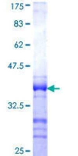 Novus Biologicals Recombinant Human TOM1 GST (N-Term) Protein 25 &mu;g | Buy Online | Novus Biologicals&trade; | Fisher Scientific