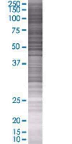 Novus Biologicals&trade;&nbsp;TOM1 293T Cell Transient Overexpression Lysate
