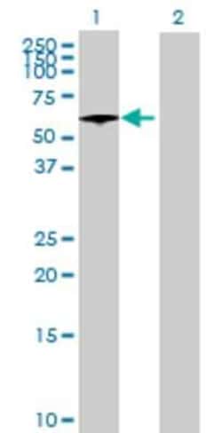 Novus Biologicals TOM1 293T Cell Transient Overexpression Lysate 0.1 mL | Buy Online | Novus Biologicals&trade; | Fisher Scientific