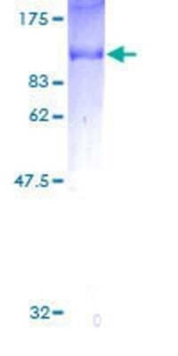 Novus Biologicals Recombinant Human SH2D3C GST (N-Term) Protein 2 &mu;g | Buy Online | Novus Biologicals&trade; | Fisher Scientific