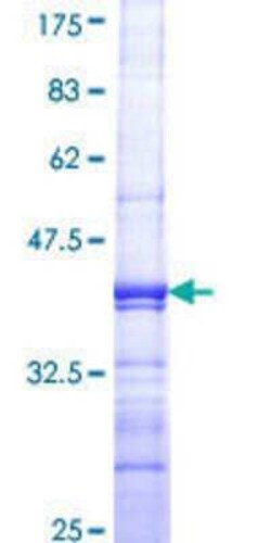 Novus Biologicals Recombinant Human SH2D3C GST (N-Term) Protein 25 &mu;g | Buy Online | Novus Biologicals&trade; | Fisher Scientific