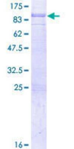 Novus Biologicals Recombinant Human SH2D3A GST (N-Term) Protein 25 &mu;g | Buy Online | Novus Biologicals&trade; | Fisher Scientific