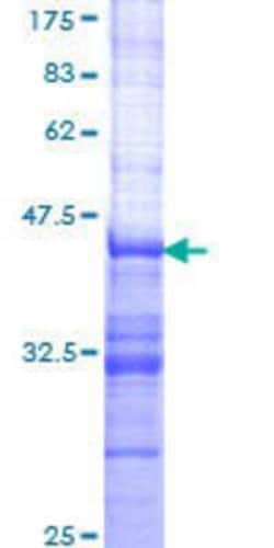 Novus Biologicals Recombinant Human SH2D3A GST (N-Term) Protein 10 &mu;g | Buy Online | Novus Biologicals&trade; | Fisher Scientific