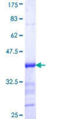 Novus Biologicals Recombinant Human MAmLD1 GST (N-Term) Protein 10 &mu;g | Buy Online | Novus Biologicals&trade; | Fisher Scientific