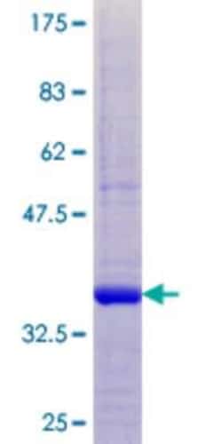 Novus Biologicals Recombinant Human Cystatin-8 GST (N-Term) Protein 25 &mu;g | Buy Online | Novus Biologicals&trade; | Fisher Scientific