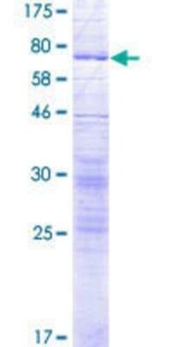 Novus Biologicals Recombinant Human SLC17A4 GST (N-Term) Protein 2 &mu;g | Buy Online | Novus Biologicals&trade; | Fisher Scientific