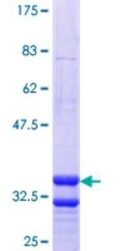 Novus Biologicals Recombinant Human SLC17A4 GST (N-Term) Protein 25 &mu;g | Buy Online | Novus Biologicals&trade; | Fisher Scientific
