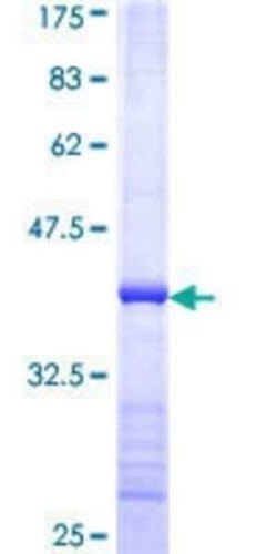 Novus Biologicals Recombinant Human SMC4 GST (N-Term) Protein 10 &mu;g | Buy Online | Novus Biologicals&trade; | Fisher Scientific