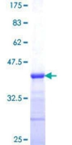 Novus Biologicals Recombinant Human Connexin 45/GJC1 GST (N-Term) Protein 10 &mu;g | Buy Online | Novus Biologicals&trade; | Fisher Scientific