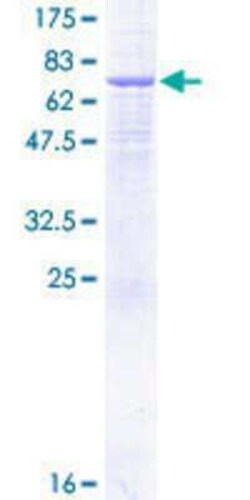 Novus Biologicals Recombinant Human AP1M2 GST (N-Term) Protein 10 &mu;g | Buy Online | Novus Biologicals&trade; | Fisher Scientific