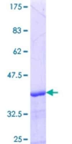 Novus Biologicals Recombinant Human ABCC5 GST (N-Term) Protein 25 &mu;g | Buy Online | Novus Biologicals&trade; | Fisher Scientific