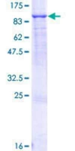 Novus Biologicals Recombinant Human ABCF2 GST (N-Term) Protein 25 &mu;g | Buy Online | Novus Biologicals&trade; | Fisher Scientific