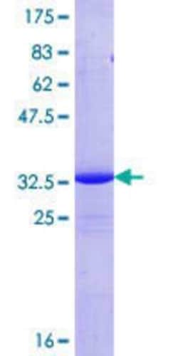 Novus Biologicals Recombinant Human COX17 GST (N-Term) Protein 25 &mu;g | Buy Online | Novus Biologicals&trade; | Fisher Scientific