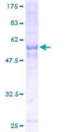 Novus Biologicals Recombinant Human SCAMP2 GST (N-Term) Protein 10 &mu;g | Buy Online | Novus Biologicals&trade; | Fisher Scientific