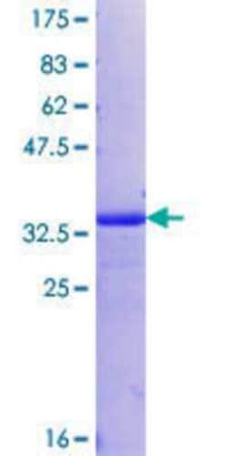 Novus Biologicals Recombinant Human MUC12 GST (N-Term) Protein 10 &mu;g | Buy Online | Novus Biologicals&trade; | Fisher Scientific