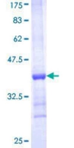 Novus Biologicals Recombinant Human HUWE1 GST (N-Term) Protein 10 &mu;g | Buy Online | Novus Biologicals&trade; | Fisher Scientific