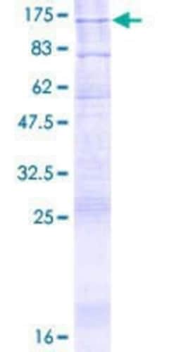 Novus Biologicals Recombinant Human ATP9A GST (N-Term) Protein 2 &mu;g | Buy Online | Novus Biologicals&trade; | Fisher Scientific