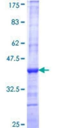 Novus Biologicals Recombinant Human ATP9A GST (N-Term) Protein 10 &mu;g | Buy Online | Novus Biologicals&trade; | Fisher Scientific