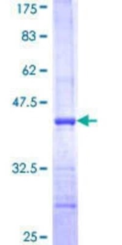 Novus Biologicals Recombinant Human ARPC4 GST (N-Term) Protein 10 &mu;g | Buy Online | Novus Biologicals&trade; | Fisher Scientific