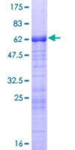 Novus Biologicals Recombinant Human actin-related protein 2/3 complex subunit 1B GST (N-Term) Protein 10 &mu;g | Buy Online | Novus Biologicals&trade; | Fisher Scientific