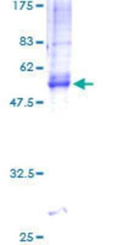 Novus Biologicals Recombinant Human Tetraspanin-5 GST (N-Term) Protein 2 &mu;g | Buy Online | Novus Biologicals&trade; | Fisher Scientific