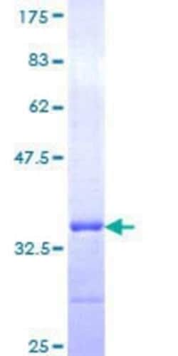Novus Biologicals Recombinant Human TSPAN2 GST (N-Term) Protein 25 &mu;g | Buy Online | Novus Biologicals&trade; | Fisher Scientific