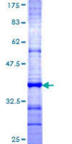 Novus Biologicals&trade;&nbsp;Recombinant Human TSPAN1 GST (N-Term) Protein