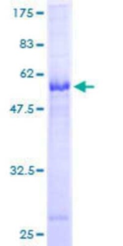 Novus Biologicals Recombinant Human CTDSP2 GST (N-Term) Protein 25 &mu;g | Buy Online | Novus Biologicals&trade; | Fisher Scientific