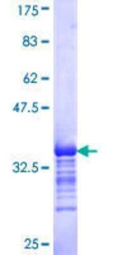 Novus Biologicals Recombinant Human SGK2 GST (N-Term) Protein 25 &mu;g | Buy Online | Novus Biologicals&trade; | Fisher Scientific