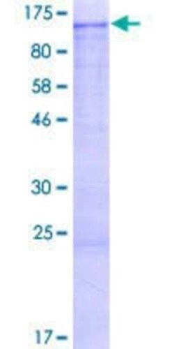 Novus Biologicals Recombinant Human KIF20A GST (N-Term) Protein 2 &mu;g | Buy Online | Novus Biologicals&trade; | Fisher Scientific