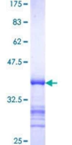 Novus Biologicals Recombinant Human PREB GST (N-Term) Protein 10 &mu;g | Buy Online | Novus Biologicals&trade; | Fisher Scientific
