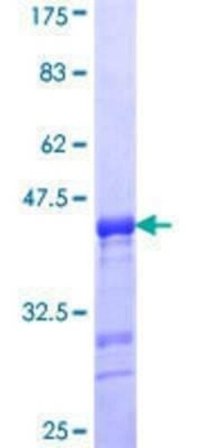 Novus Biologicals Recombinant Human Enamelin GST (N-Term) Protein 25 &mu;g | Buy Online | Novus Biologicals&trade; | Fisher Scientific