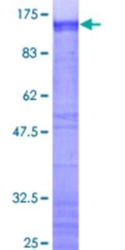 Novus Biologicals Recombinant Human ZNF263 GST (N-Term) Protein 2 &mu;g | Buy Online | Novus Biologicals&trade; | Fisher Scientific