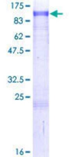 Novus Biologicals Recombinant Human ZNF263 GST (N-Term) Protein 10 &mu;g | Buy Online | Novus Biologicals&trade; | Fisher Scientific