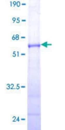 Novus Biologicals Recombinant Human ELA3A GST (N-Term) Protein 25 &mu;g | Buy Online | Novus Biologicals&trade; | Fisher Scientific