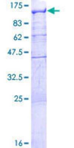 Novus Biologicals Recombinant Human RBM12 GST (N-Term) Protein 10 &mu;g | Buy Online | Novus Biologicals&trade; | Fisher Scientific