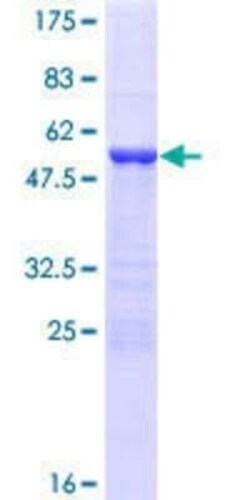 Novus Biologicals Recombinant Human YAF2 GST (N-Term) Protein 25 &mu;g | Buy Online | Novus Biologicals&trade; | Fisher Scientific