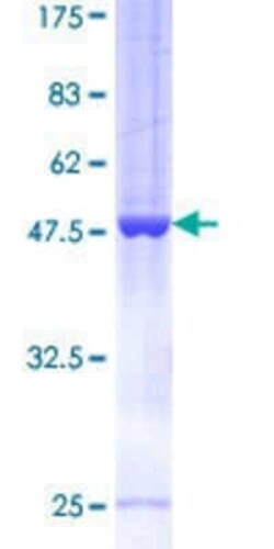Novus Biologicals Recombinant Human ARFRP1 GST (N-Term) Protein 25 &mu;g | Buy Online | Novus Biologicals&trade; | Fisher Scientific